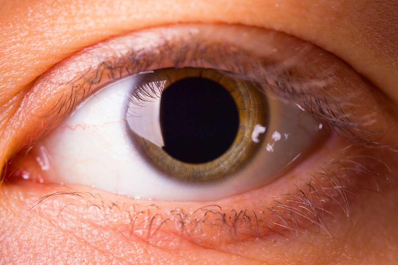 Drugs And Dilated Pupils Causes And Risks 